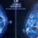 FDA’s new regulations underscore the complexity around screening for women with dense breasts