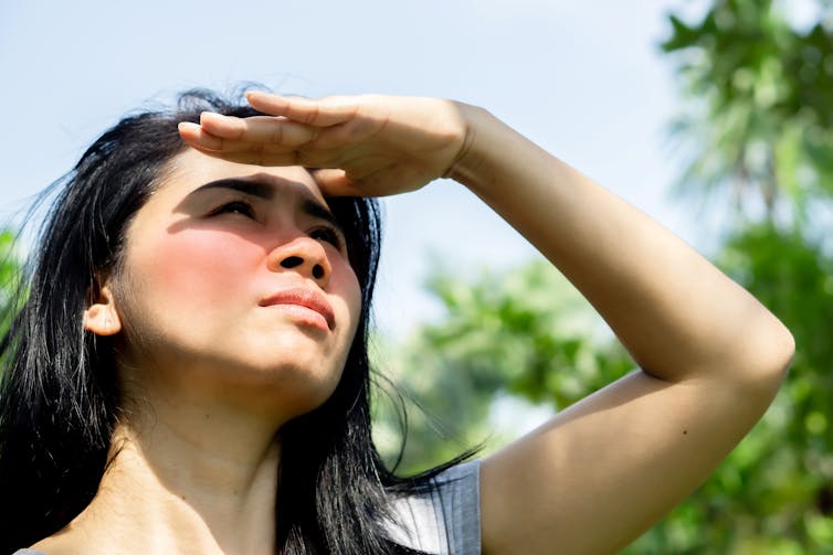 A woman with a sunburn on her cheeks looks up at the sky.