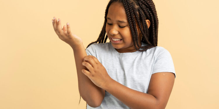 Caring for a Child With Eczema: Practical Tips for Parents