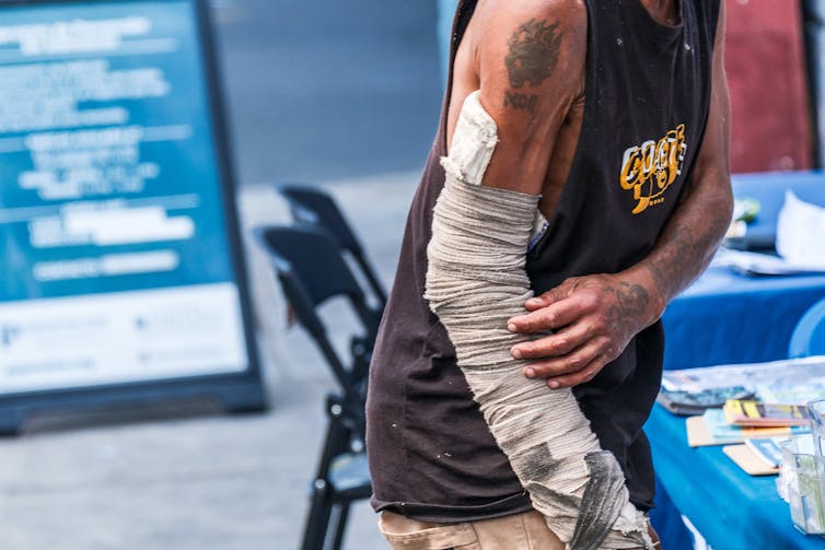 Torso of person wearing black tank top and dirty bandage from bicep to wrist