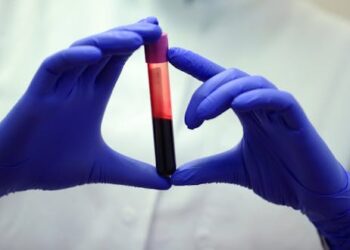 Blood tests are currently one-size-fits-all − machine learning can pinpoint what’s truly ‘normal’ for each patient