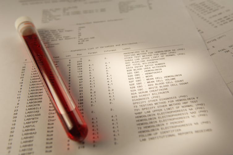 Blood tube on top of print out of lab results