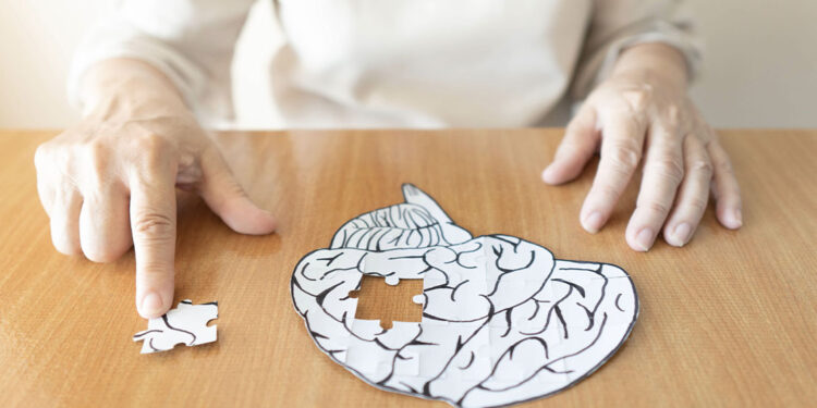 Study Finds Aerobic Exercise Improves Alzheimer’s Disease Cognitive Function