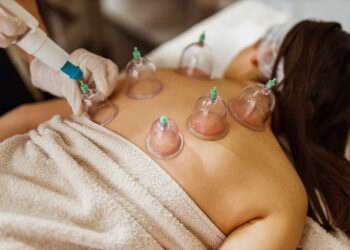 Is Cupping Right for You? Everything To Know About Its Benefits and Risks