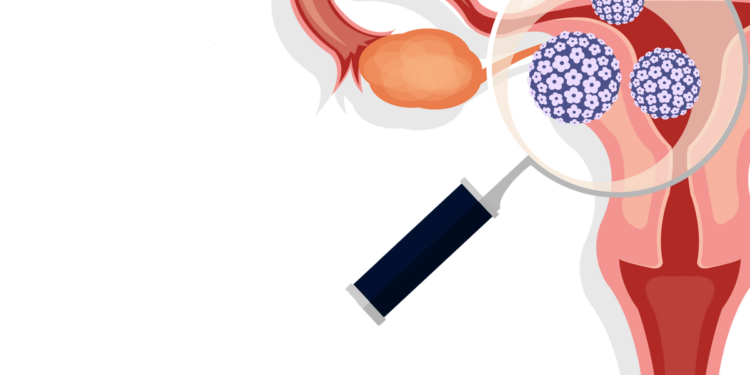 HPV Vaccination Around the World