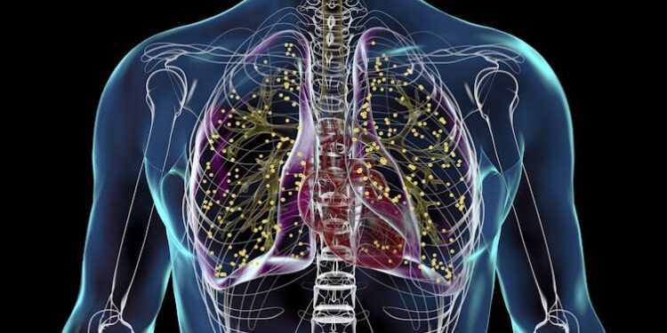 As tuberculosis cases rise in the US and worldwide, health officials puzzle over the resurgence of a disease once in decline