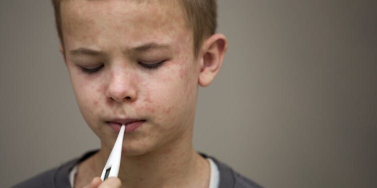 Measles cases are on the rise − here’s how to make sure you’re protected