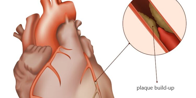 Too much sitting increases risk of future health problems in chest pain patients – new research