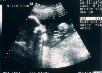 Keeping brain-dead pregnant women on life support raises ethical issues that go beyond abortion politics