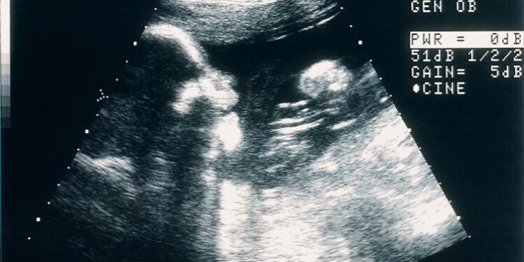 Keeping brain-dead pregnant women on life support raises ethical issues that go beyond abortion politics