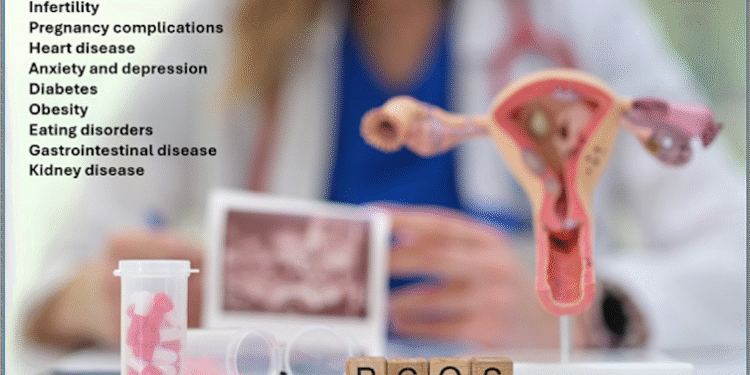 Polycystic ovary syndrome (PCOS) is a big threat to women’s health, but it’s still under-recognized, under-diagnosed and under-treated