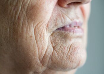 Why aging shouldn’t be classified as a disease