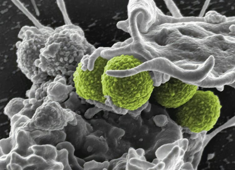 Round green bacteria in a grey matrix