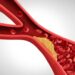 How C-reactive protein outpaced ‘bad’ cholesterol as leading heart disease risk marker