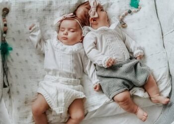 Experience: my daughters were born conjoined at the head