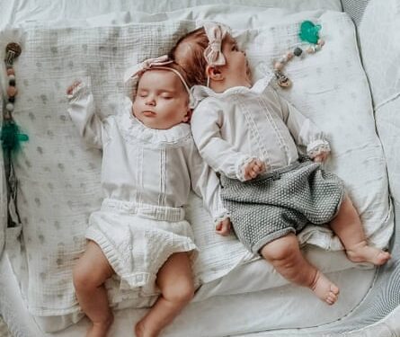 Experience: my daughters were born conjoined at the head