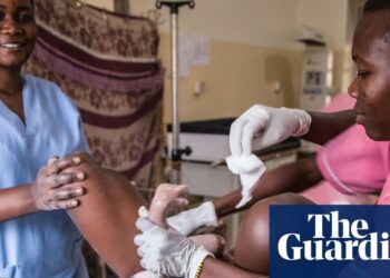 Global midwife shortage raises rates of maternity intervention, report warns