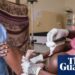 Global midwife shortage raises rates of maternity intervention, report warns