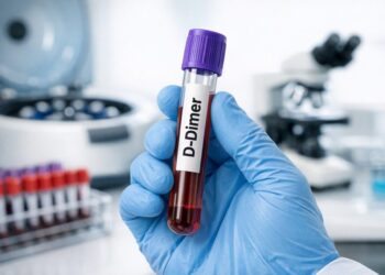D-Dimer: Test Results Interpretation Guide