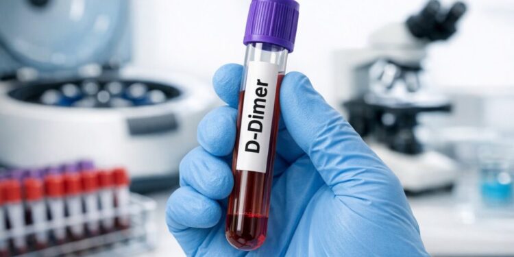 D-Dimer: Test Results Interpretation Guide