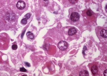 US exit from the World Health Organization marks a new era in global health policy – here’s what the US, and world, will lose