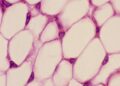 Fat cells burn energy to make heat – making them the next frontier of weight loss therapies