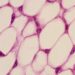 Fat cells burn energy to make heat – making them the next frontier of weight loss therapies