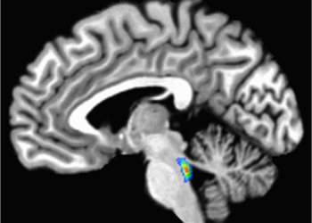 Vagus nerve stimulation shows promise as a way to counter Alzheimer’s disease- and age-related memory loss