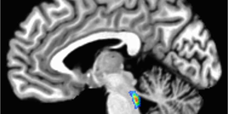 Vagus nerve stimulation shows promise as a way to counter Alzheimer’s disease- and age-related memory loss