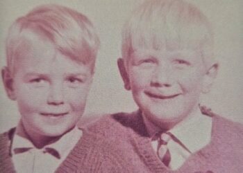 A moment that changed me: I cried about my cleft lip for the first time in my 60s