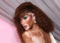 Winnie Harlow Is Embracing Vitiligo in a New Way