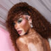 Winnie Harlow Is Embracing Vitiligo in a New Way