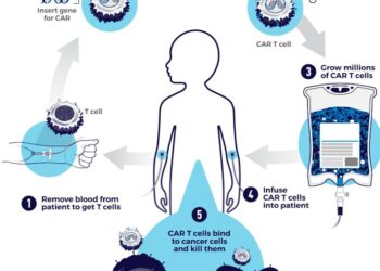 Treating previously untreatable cancers: How CAR-T cell therapy could be made accessible to more patients
