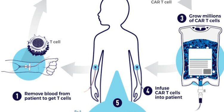 Treating previously untreatable cancers: How CAR-T cell therapy could be made accessible to more patients