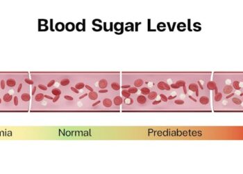 Wearable glucose monitors offer real-time data, but for healthy people no guidelines exist to interpret the numbers
