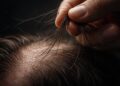 Can You Reverse Hair Damage Naturally? Effective Natural Repair Methods
