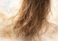 Why Is My Hair So Dry and Brittle? Causes, Solutions & Prevention