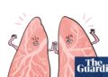 Is it true that … your lungs regenerate when you quit smoking?