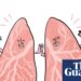 Is it true that … your lungs regenerate when you quit smoking?
