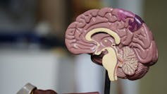 Medial view of the human brain