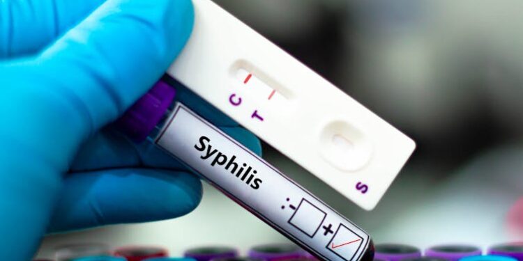 Syphilis cases in expectant mothers have dramatically risen since the pandemic – here’s what’s driving the trend