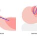 Sleep apnea compromises far more than a good night’s rest – 2 neuroscientists outline the risks and the need for better diagnosis