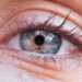 Is rubbing your eyes bad for you? 2 eye specialists explain what’s behind the urge to rub and what to do about it