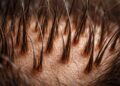 The Truth About Hair Growth Products: Evidence, Safety & Best Picks