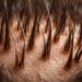 The Truth About Hair Growth Products: Evidence, Safety & Best Picks