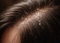 Quick Fixes for Common Hair Problems: Effective Solutions & Tips
