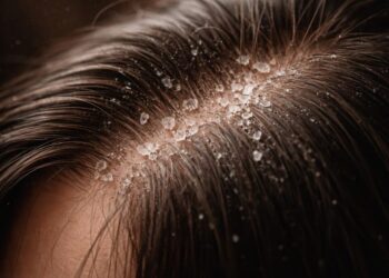 Quick Fixes for Common Hair Problems: Effective Solutions & Tips