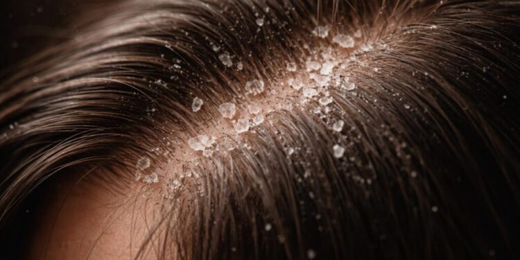 Quick Fixes for Common Hair Problems: Effective Solutions & Tips