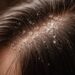 Quick Fixes for Common Hair Problems: Effective Solutions & Tips