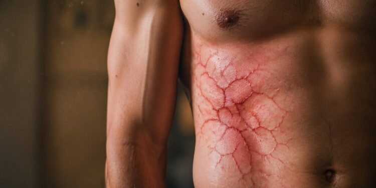 Is Chronic Inflammation Making You Feel Sick? Signs, Causes, and Solutions